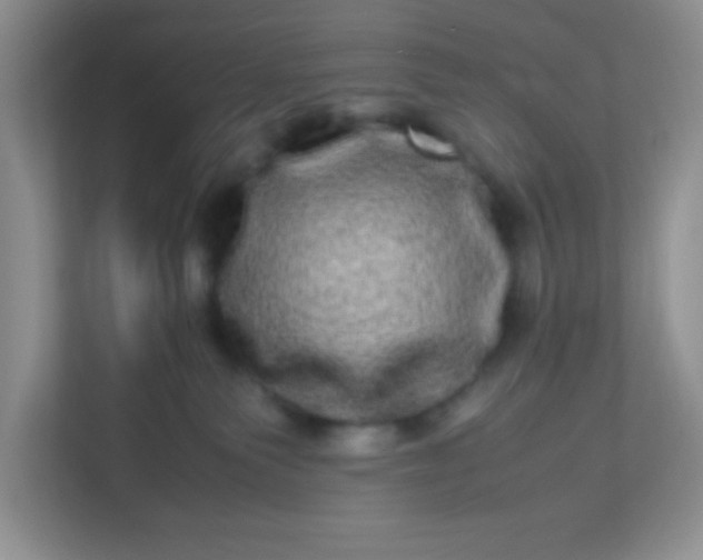 X0000113290135200909281020