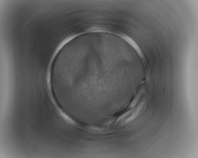 X0000113291149200909281007