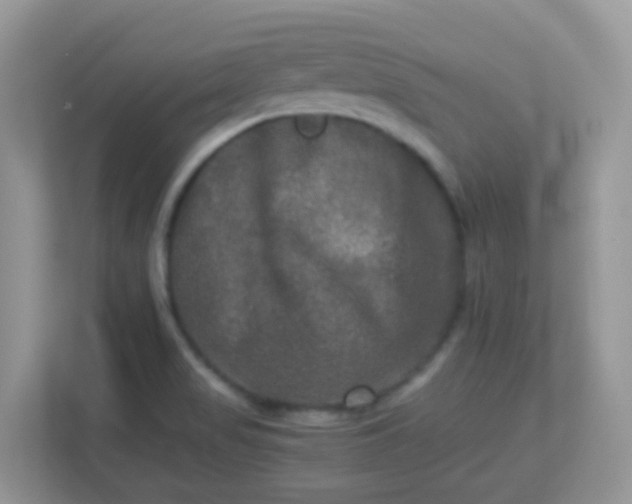 X0000113291517200909281001