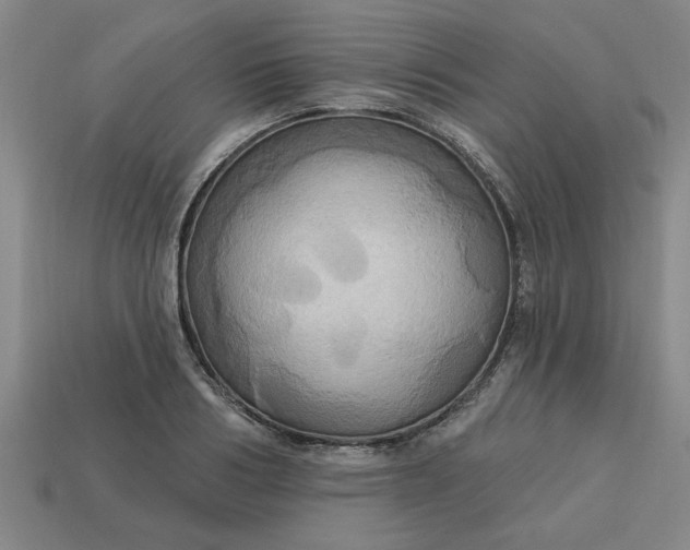 X0000113300986200910051038