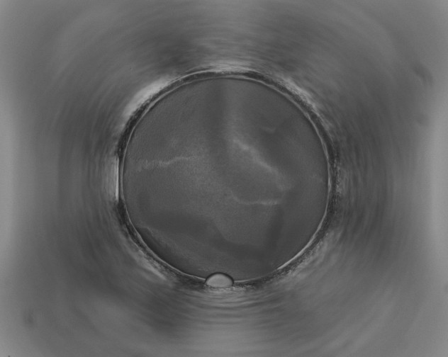 X0000113301171200910051036