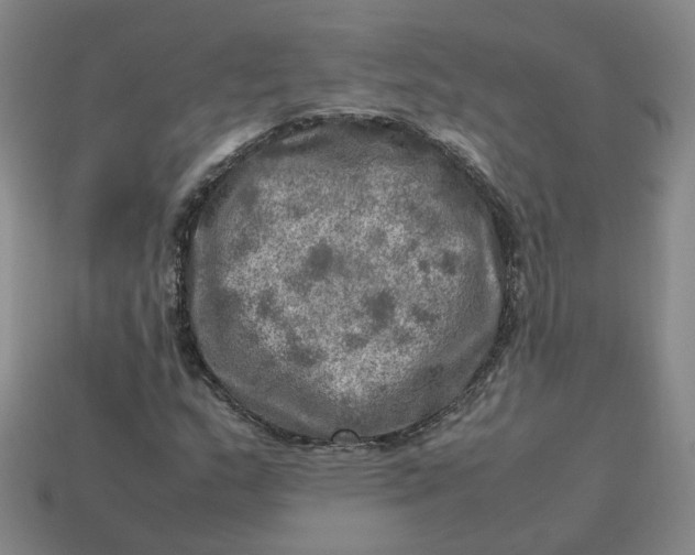 X0000113311159200910051057