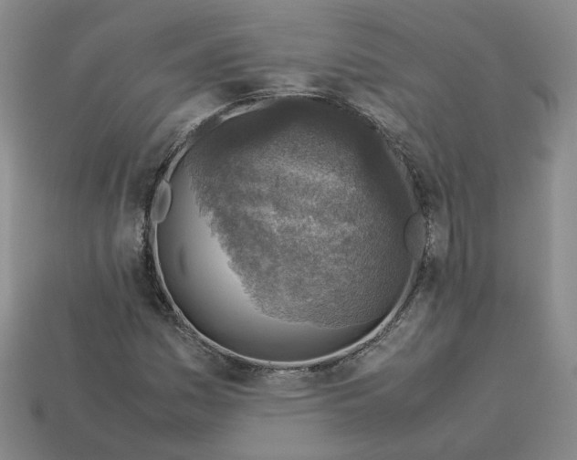 X0000113311161200910051057