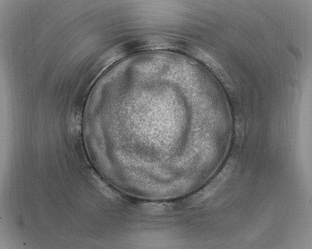 X0000113311185200910051057