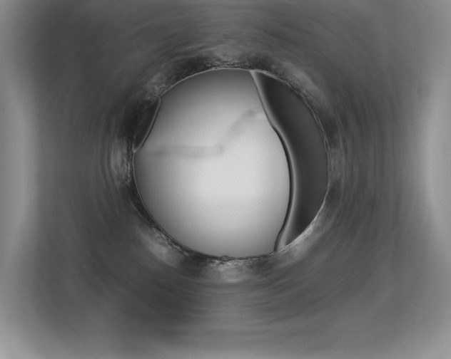 X0000113330186200909141014