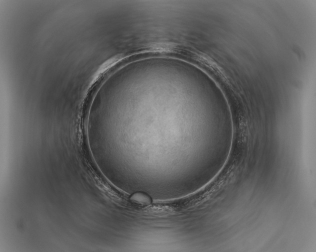 X0000113341168200909151125