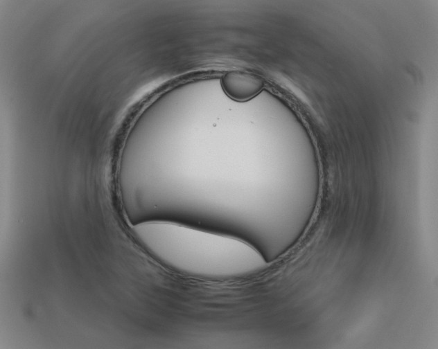 X0000113351315200909151018