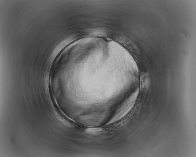 X0000113350051200910061027