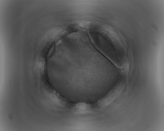 X0000113350231200910061025