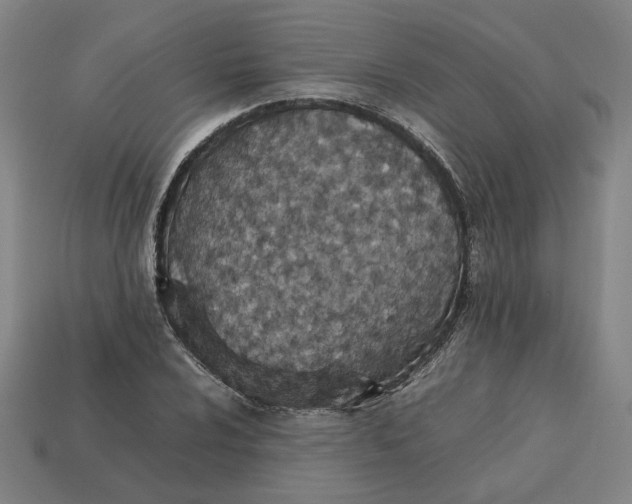 X0000113351024200910061014