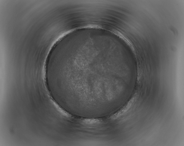 X0000113351037200910061014