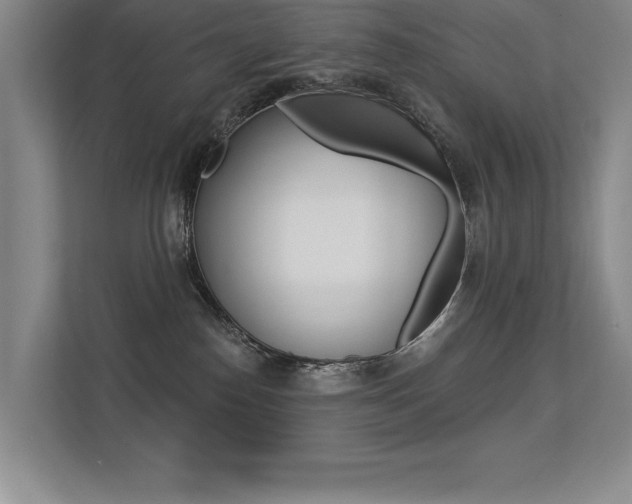 X0000113360186200909151014