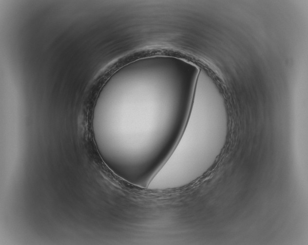 X0000113360872200909151004