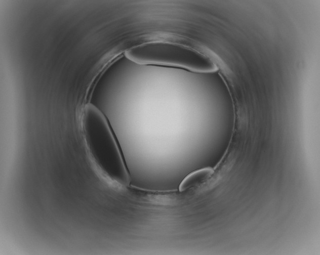 X0000113360946200909151004