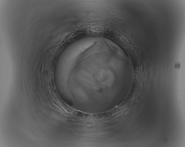 X0000113361009200909221154