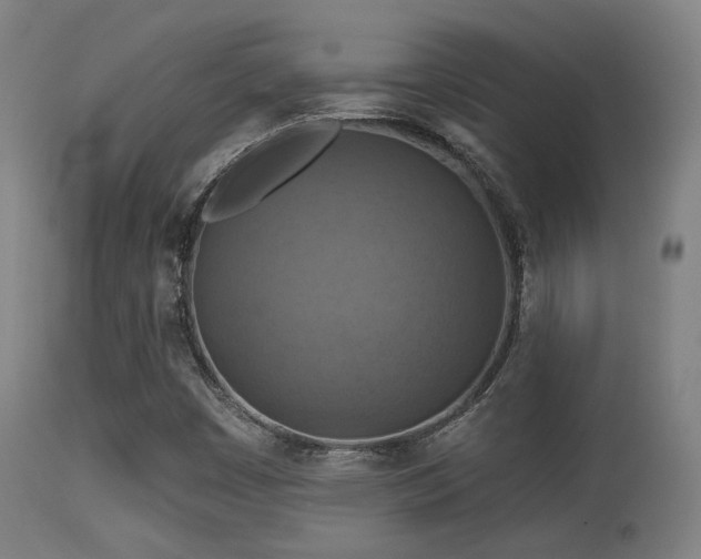 X0000113361449200909221147