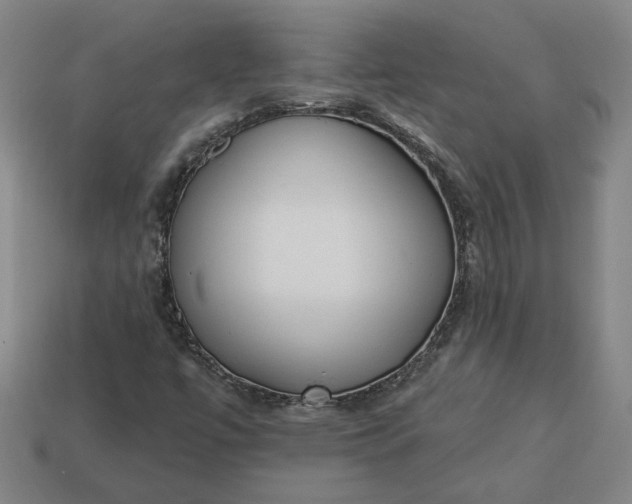 X0000113361447200909291020