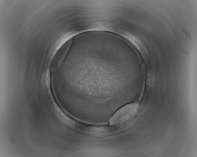 X0000113361468200909291020