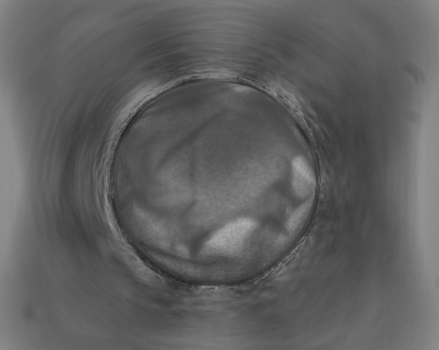 X0000113360145200910061047