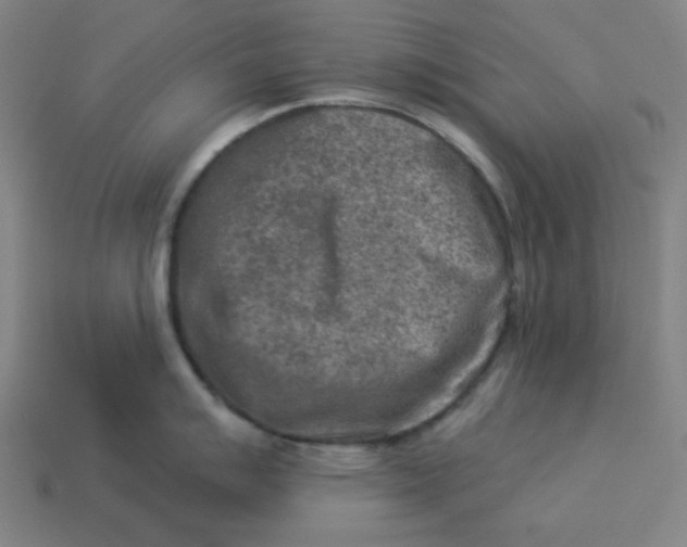 X0000113361007200910061036