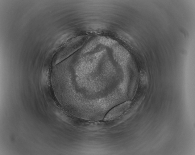 X0000113361060200910061035