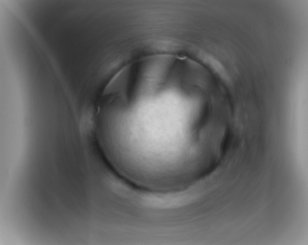 X0000113540017200910021358