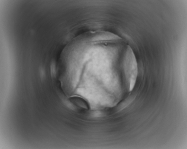 X0000113540287200910021356