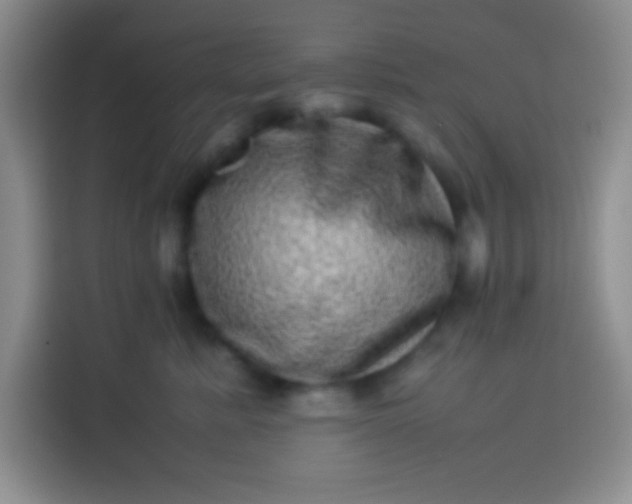 X0000113540619200910021351