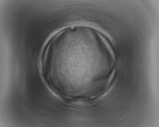 X0000113541517200910021339