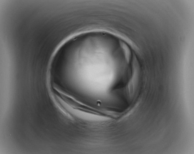 X0000113541518200910021339