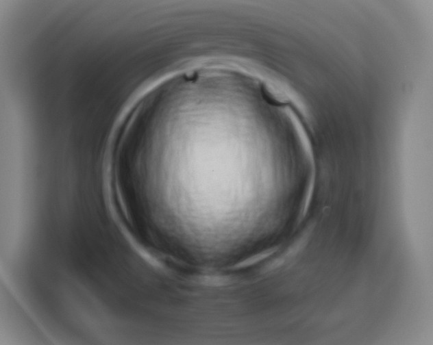 X0000113541525200910021339