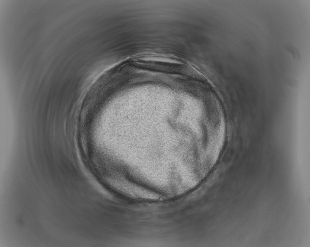 X0000113540049200910091252