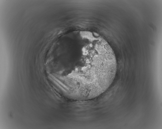 X0000113541009200910091238