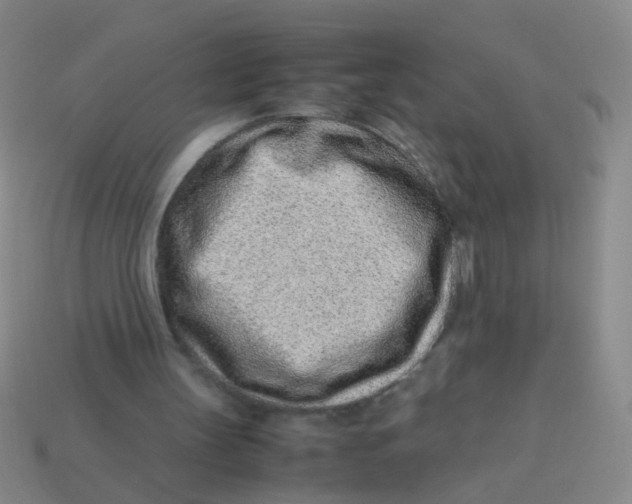X0000113540147200910161419
