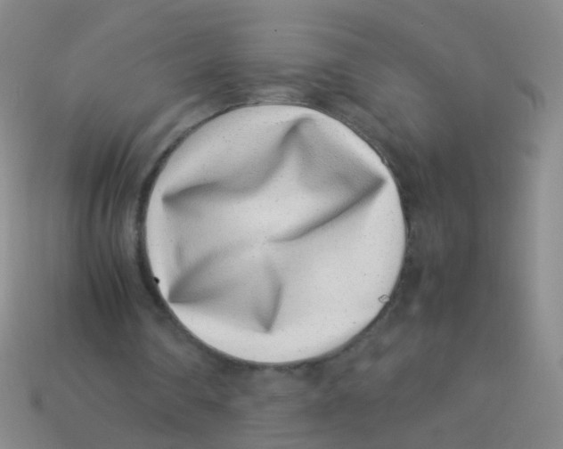 X0000113540290200910161418