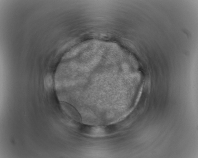 X0000113540335200910161417