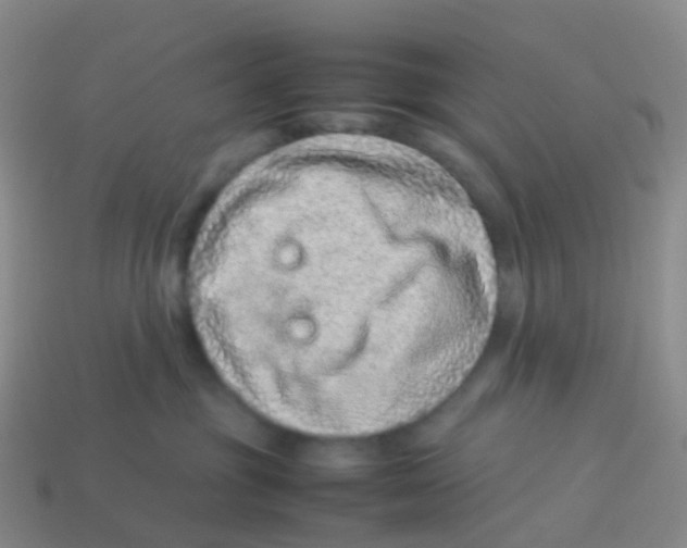 X0000113540381200910161417