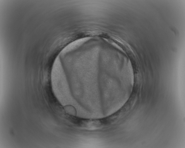 X0000113540517200910161415