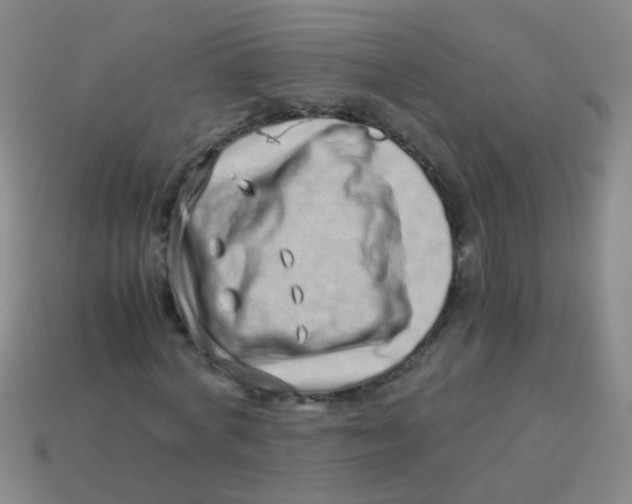 X0000113540772200910161411