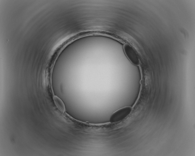 X0000113551069200909180954