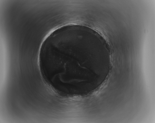 X0000113550196200909251045