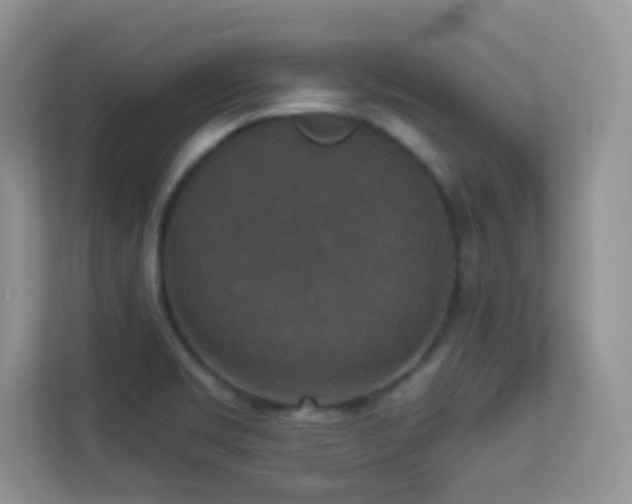 X0000113551469200909251028