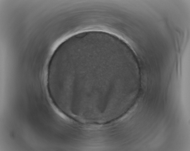 X0000113551519200910091253