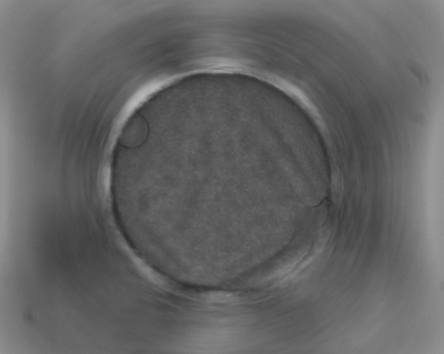 X0000113551424200910161424