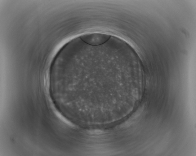 X0000113551515200910161422