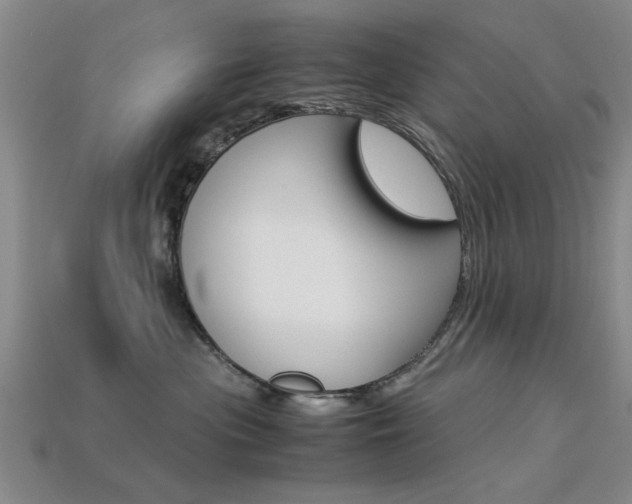 X0000113560477200909181025