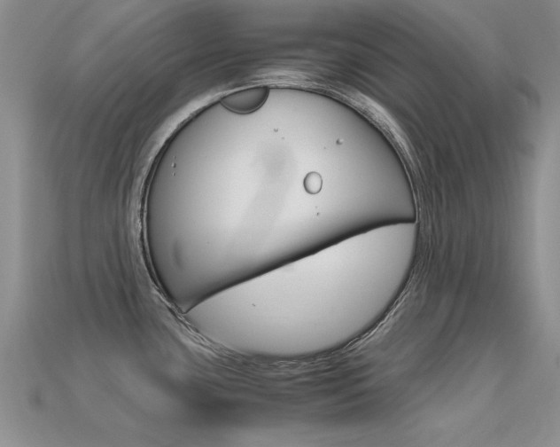 X0000113561435200909181011