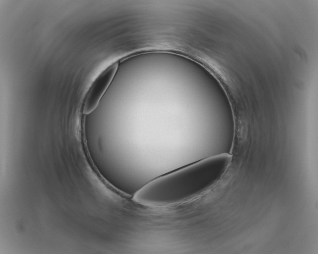 X0000113561468200909181010