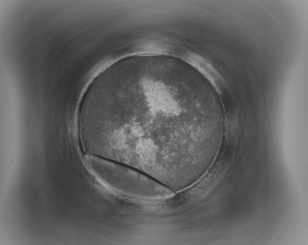 X0000113561477200909181209