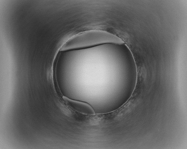 X0000113560148200909251105